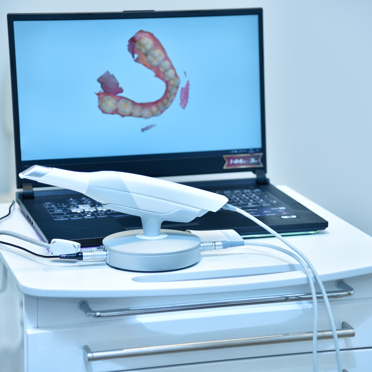 scanner